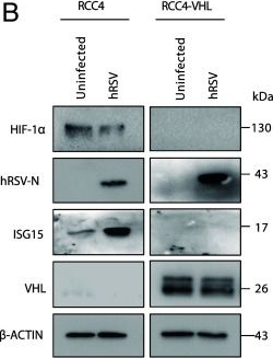 Fig.6.B showing Western Blotting from the publication: Hypoxia inducible factors regulate pneumovirus replication by enhancing innate immune sensing.