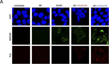 Fig.3.A showing Immunocytochemistry-immunofluorescence from the publication: NMDA receptor-BK channel coupling regulates synaptic plasticity in the barrel cortex.