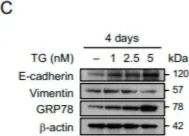 Fig.1.C showing Western Blotting from the publication: Adaptation to Endoplasmic Reticulum Stress Enhances Resistance of Oral Cancer Cells to Cisplatin by Up-Regulating Polymerase η and Increasing DNA Repair Efficiency.