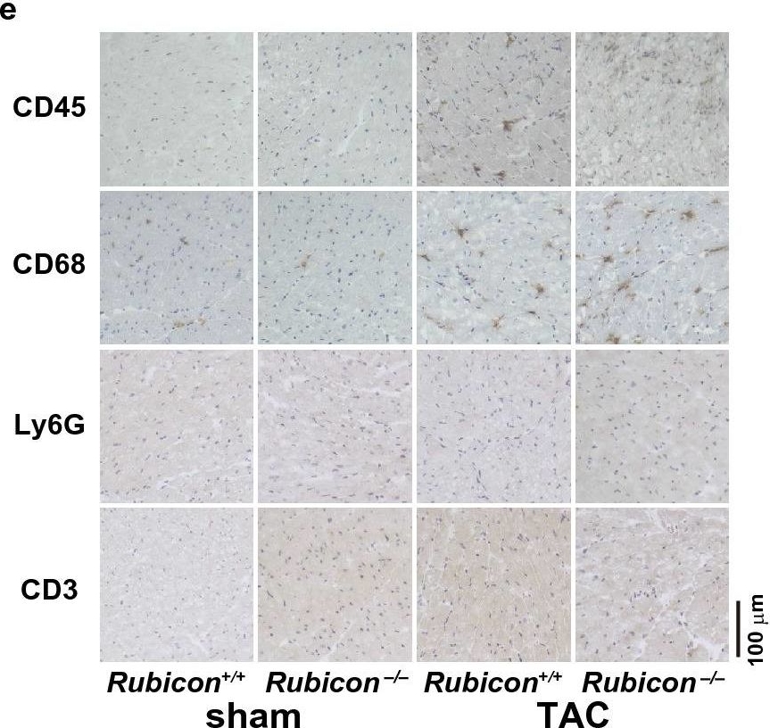 Fig.2.E showing Immunohistochemistry in a Rattus norvegicus (Rat) sample from the publication: Rubicon-regulated beta-1 adrenergic receptor recycling protects the heart from pressure overload.