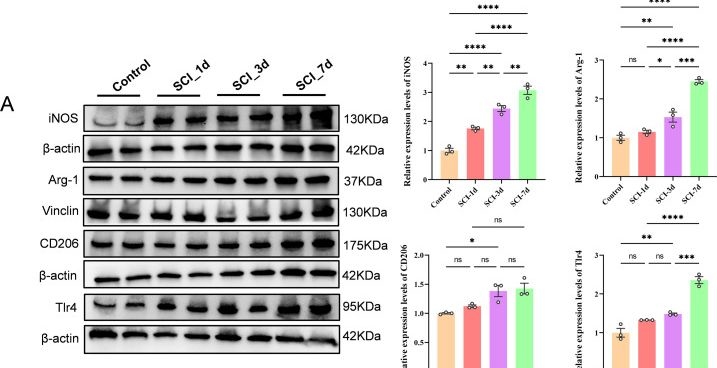 Fig.9.A showing Western Blotting from the publication: Ferroptosis-associated myeloid cell heterogeneity and inflammatory amplification following spinal cord injury.