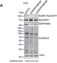 Fig.4.A showing Western Blotting in a Heterocephalus glaber (Naked mole rat) sample from the publication: SERPINB3 enhances NPM1 sumoylation via inhibiting SENP3's activity and promotes lung tumorigenesis.
