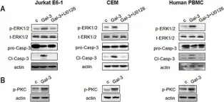 Fig.4.A showing Western Blotting from the publication: The N-terminal tail coordinates with carbohydrate recognition domain to mediate galectin-3 induced apoptosis in T cells.