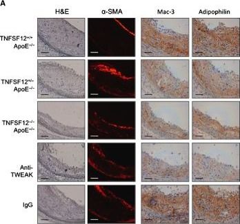 Genetic deletion or TWEAK blocking antibody administration reduce atherosclerosis and enhance plaque stability in mice.