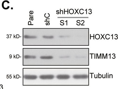 Fig.7.C showing Chromatin immunoprecipitation in a Homo sapiens (Human) sample from the publication: HOXC13-driven TIMM13 overexpression promotes osteosarcoma cell growth.