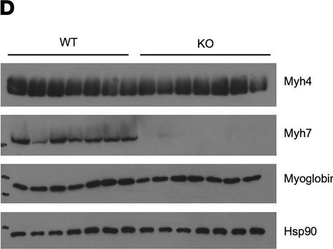 Fig.3.D showing Western Blotting from the publication: The hepatokine TSK maintains myofiber integrity and exercise endurance and contributes to muscle regeneration.