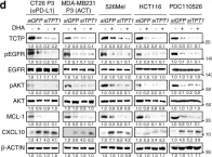 Fig.6.D showing Western Blotting from the publication: Targeting TCTP sensitizes tumor to T cell-mediated therapy by reversing immune-refractory phenotypes.