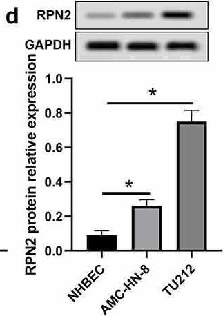 Fig.1.D showing Western Blotting in a Homo sapiens (Human) sample from the publication: Ribophorin II promotes the epithelial-mesenchymal transition and aerobic glycolysis of laryngeal squamous cell carcinoma via regulating reactive oxygen species-mediated Phosphatidylinositol-3-Kinase/Protein Kinase B activation.