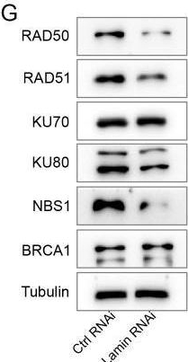 Fig.2.G showing Western Blotting from the publication: Lamins regulate cancer cell plasticity and chemosensitivity.
