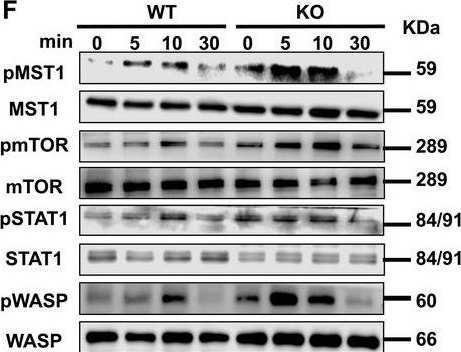 Fig.4.F showing Western Blotting from the publication: PGRN Inhibits Early B-cell Activation and IgE Production Through the IFITM3-STAT1 Signaling Pathway in Asthma.