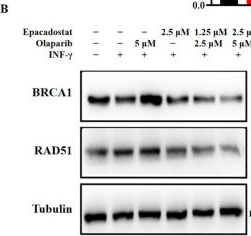 Fig.7.B showing Western Blotting in a Homo sapiens (Human) sample from the publication: Epacadostat and Olaparib Synergistically Inhibit the Growth of BRCA-Proficient Triple-Negative Breast Cancer by Suppressing the Expression of BRCA1 and RAD51.