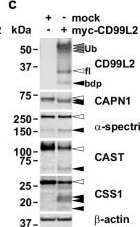 Fig.5.C showing Western Blotting from the publication: Loss-of-function variants in the CAPN1 activator CD99L2 cause X-linked spastic ataxia.