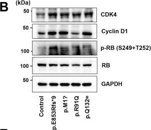 Fig.3.B showing Western Blotting in a Homo sapiens (Human) sample from the publication: Mutations in NEK1 cause ciliary dysfunction as a novel pathogenic mechanism in amyotrophic lateral sclerosis.
