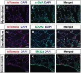 Fig.2.D showing Immunohistochemistry-immunofluorescence in a Mus musculus (House mouse) sample from the publication: Pdgfra marks a cellular lineage with distinct contributions to myofibroblasts in lung maturation and injury response.