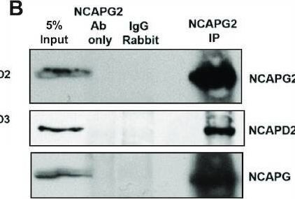 Fig.4.B showing Western Blotting in a Rattus norvegicus (Rat) sample from the publication: Condensin I and condensin II proteins form a LINE-1 dependent super condensin complex and cooperate to repress LINE-1.