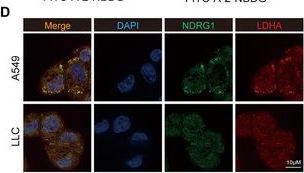 Fig.3.D showing Immunocytochemistry-immunofluorescence from the publication: NDRG1-Driven Lactate Accumulation Promotes Lung Adenocarcinoma Progression Through the Induction of an Immunosuppressive Microenvironment.