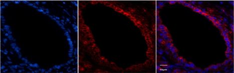 Anti-rabbit IgG (H+L), F(ab')2 Fragment (Alexa Fluor® 594 Anti-rabbit IgG (H+L), F(ab')2 Fragment (Alexa Fluor® 594