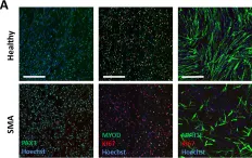 Fig.2.A showing Immunocytochemistry-immunofluorescence in a Homo sapiens (Human) sample from the publication: Impaired myogenic development, differentiation and function in hESC-derived SMA myoblasts and myotubes.