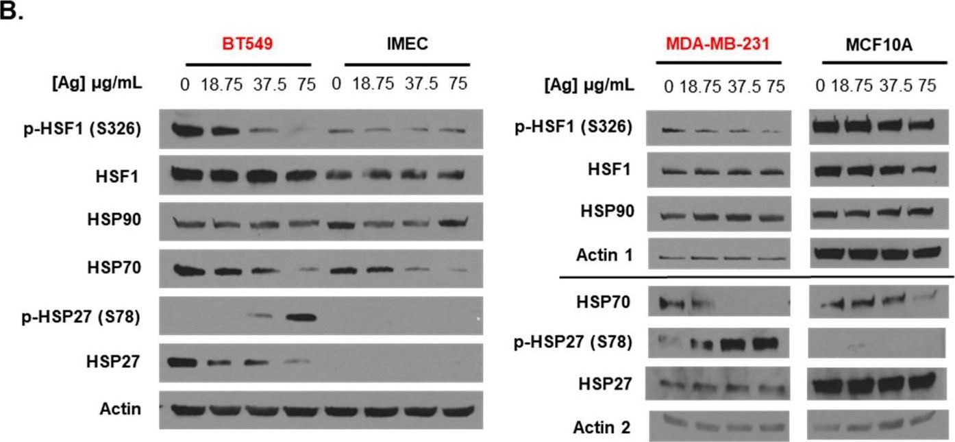 Fig.1.B showing Western Blotting in a Homo sapiens (Human) sample from the publication: Enhancement of Triple-Negative Breast Cancer-Specific Induction of Cell Death by Silver Nanoparticles by Combined Treatment with Proteotoxic Stress Response Inhibitors.
