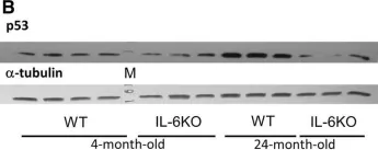 Fig.1.B showing Western Blotting in a Mus musculus (House mouse) sample from the publication: IL-6 deficiency attenuates p53 protein accumulation in aged male mouse hippocampus.