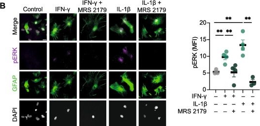 Fig.2.B showing Immunocytochemistry-immunofluorescence in a Mus musculus (House mouse) sample from the publication: Neuroglial P2Y1 receptor signalling differentially contributes to inflammatory neurodegeneration.