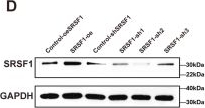 Fig.5.D showing Western Blotting in a Homo sapiens (Human) sample from the publication: Landscape of splicing factors in early-onset gastric cancer reveals SRSF1 as a key driver of oxaliplatin resistance.