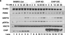 Fig.4.B showing Western Blotting in a Homo sapiens (Human) sample from the publication: CHIP/STUB1 Ubiquitin Ligase Functions as a Negative Regulator of ErbB2 by Promoting Its Early Post-Biosynthesis Degradation.