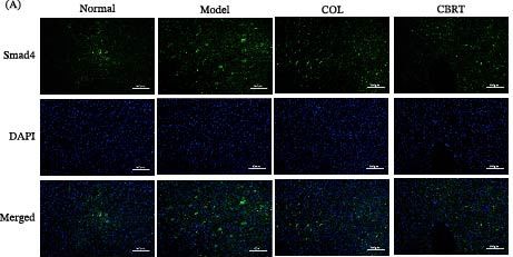 Fig.14.A showing Immunocytochemistry-immunofluorescence in a Rattus norvegicus (Rat) sample from the publication: Experimental Study of YaJieShaBa Antialcoholic Hepatic Fibrosis Through TGF-β1/Smad Signaling Pathway.