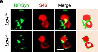 Fig.2.E showing Immunocytochemistry-immunofluorescence in a Mus musculus (House mouse) sample from the publication: Intrafusal-fiber LRP4 for muscle spindle formation and maintenance in adult and aged animals.