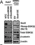 Fig.5.A showing Western Blotting from the publication: Sox9 confers stemness properties in hepatocellular carcinoma through Frizzled-7 mediated Wnt/β-catenin signaling.