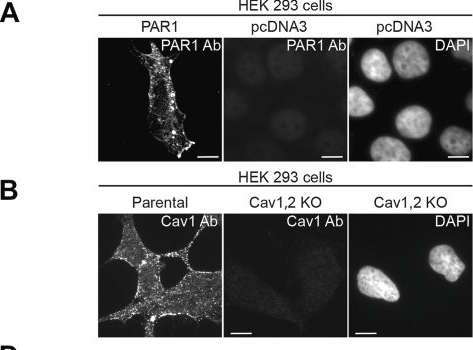 Fig.4.A showing Immunocytochemistry-immunofluorescence in a Homo sapiens (Human) sample from the publication: Activated protein C drives β-arrestin-2- and c-Src-dependent phosphorylation of Cav1 and modulates Cav1 association with PAR1 and GRK5.
