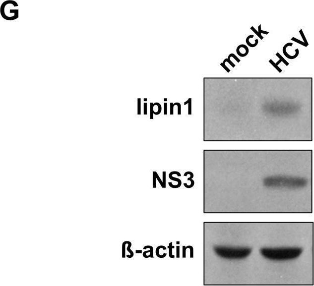 Fig.1.G showing Western Blotting from the publication: Host phosphatidic acid phosphatase lipin1 is rate limiting for functional hepatitis C virus replicase complex formation.