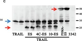 Fig.4.C showing Western Blotting in a Salmonella sample from the publication: Optimized Attenuated Salmonella Typhimurium Suppressed Tumor Growth and Improved Survival in Mice.