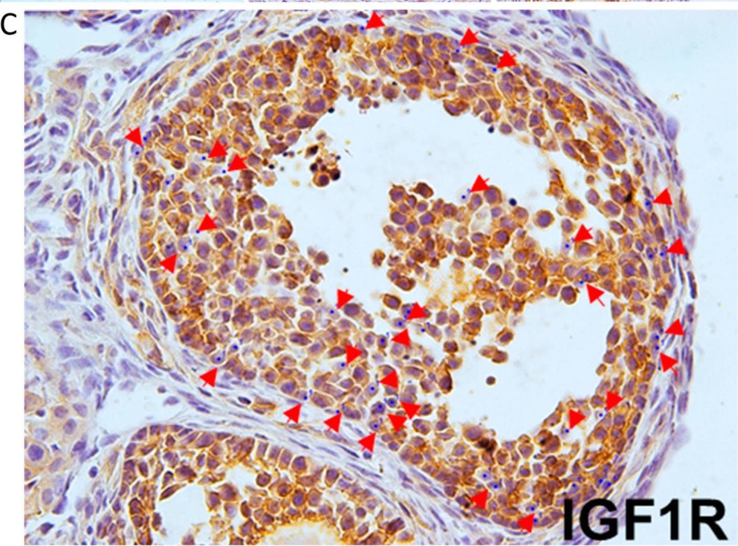 Fig.2.C showing Immunohistochemistry from the publication: Normal Ovarian Function in Subfertile Mouse with Amhr2-Cre-Driven Ablation of Insr and Igf1r.