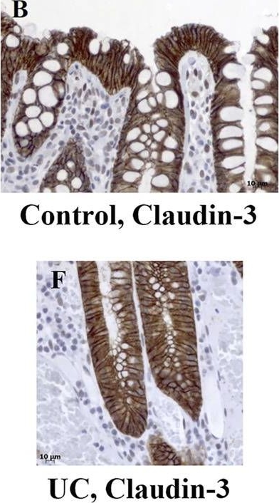 Fig.2.B showing Immunohistochemistry in a Mus musculus (House mouse) sample from the publication: Claudins: Beyond Tight Junctions in Human IBD and Murine Models.