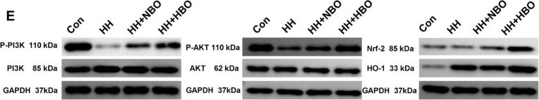 Fig.4.E showing Western Blotting in a Mus musculus (House mouse) sample from the publication: Transcriptomic profiling and targeted validation reveal molecular mechanisms of oxygen therapy in high-altitude cerebral injury.