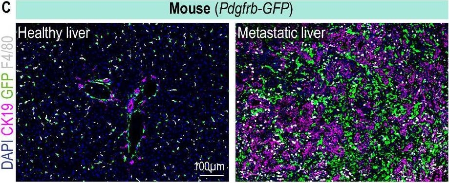 Fig.1.C showing Immunohistochemistry-immunofluorescence in a Mus musculus (House mouse) sample from the publication: Macrophage-fibroblast JAK/STAT dependent crosstalk promotes liver metastatic outgrowth in pancreatic cancer.