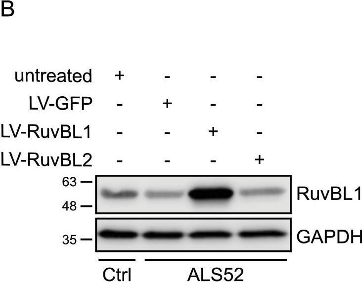 Fig.4.B showing Western Blotting in a Homo sapiens (Human) sample from the publication: RuvBL1/2 reduce toxic dipeptide repeat protein burden in multiple models of C9orf72-ALS/FTD.