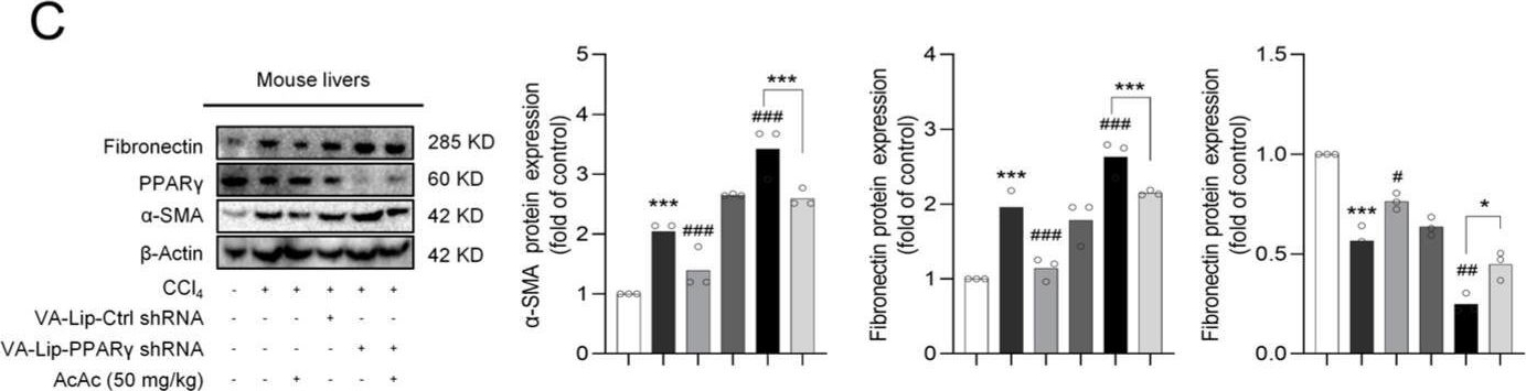 Fig.5.C showing Western Blotting from the publication: Acetoacetate Ameliorates Hepatic Fibrosis by Targeting Peroxisome Proliferator-Activated Receptor Gamma to Restore Lipid Droplets in Activated Hepatic Stellate Cells.