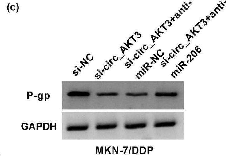 Fig.5.C showing Western Blotting from the publication: circ_AKT3 knockdown suppresses cisplatin resistance in gastric cancer.