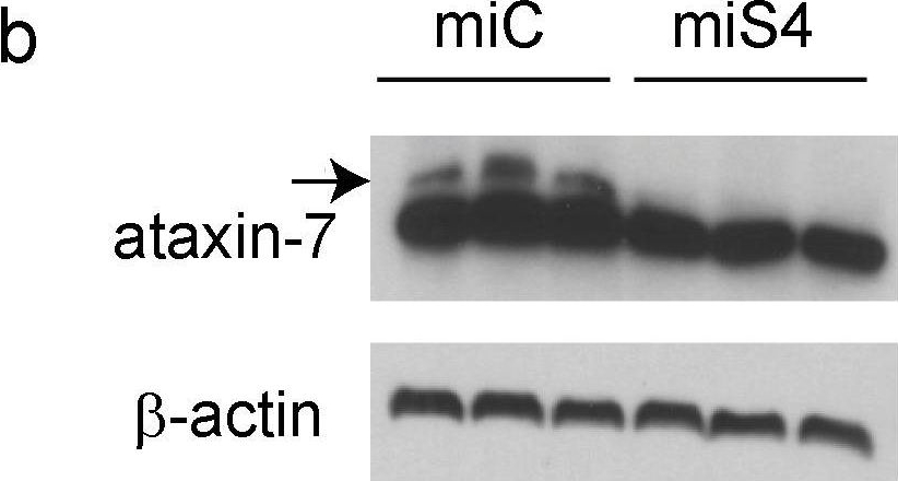 Fig.1.B showing Western Blotting from the publication: RNA interference-based therapy for spinocerebellar ataxia type 7 retinal degeneration.