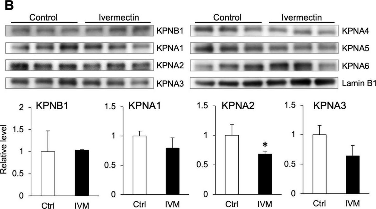 Fig.5.B showing Western Blotting in a Homo sapiens (Human) sample from the publication: Ivermectin Inhibits HBV Entry into the Nucleus by Suppressing KPNA2.