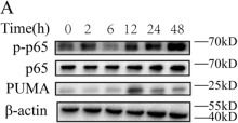 Fig.4.A showing Western Blotting from the publication: PUMA-mediated epithelial cell apoptosis promotes Helicobacter pylori infection-mediated gastritis.