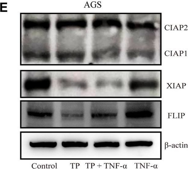 Fig.2.E showing Western Blotting from the publication: The Antigastric Cancer Effect of Triptolide is Associated With H19/NF-κB/FLIP Axis.