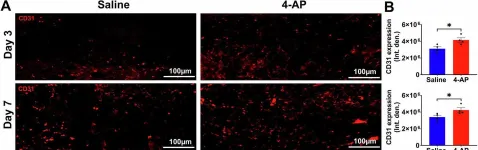 Fig.4.A showing Immunohistochemistry-immunofluorescence from the publication: 4-aminopyridine attenuates inflammation and apoptosis and increases angiogenesis to promote skin regeneration following a burn injury in mice.