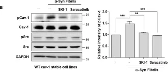 Fig.4.A showing Western Blotting from the publication: Age-related increase in caveolin-1 expression facilitates cell-to-cell transmission of α-synuclein in neurons.