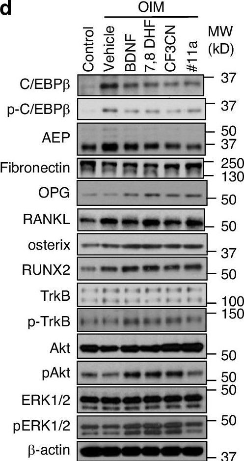Fig.4.D showing Western Blotting in a Mus musculus (House mouse) sample from the publication: C/EBPβ dictates postmenopausal FSHβ transcription and blockade of AEP/C/EBPβ pathway alleviates osteoporosis.