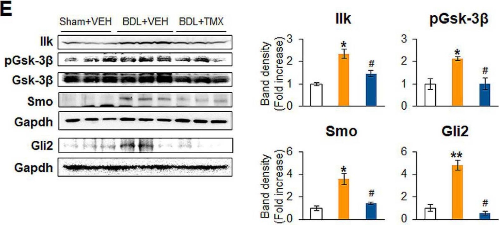 Fig.5.E showing Western Blotting in a Mus musculus (House mouse) sample from the publication: Targeted Deletion of Thymosin Beta 4 in Hepatic Stellate Cells Ameliorates Liver Fibrosis in a Transgenic Mouse Model.