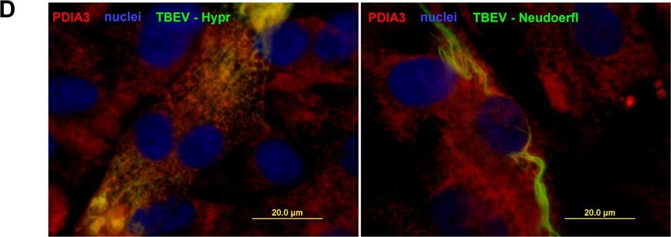 Fig.1.D showing Immunocytochemistry-immunofluorescence from the publication: Robust CXCL10/IP-10 and CCL5/RANTES Production Induced by Tick-Borne Encephalitis Virus in Human Brain Pericytes Despite Weak Infection.