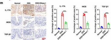 Fig.4.M showing Immunohistochemistry in a Mus musculus (House mouse) sample from the publication: IL-7R-Enriched Extracellular Vesicles From the Thymus Drive Colitis via Promoting Neutrophil Extracellular Trap Formation.